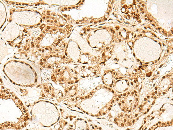 PAF1 Polyclonal Antibody Reactivity Human