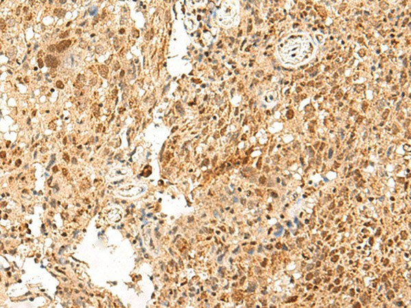 PAF1 Polyclonal Antibody Reactivity Human