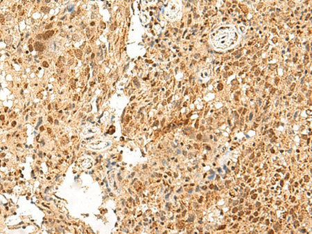 PAF1 Polyclonal Antibody Reactivity Human