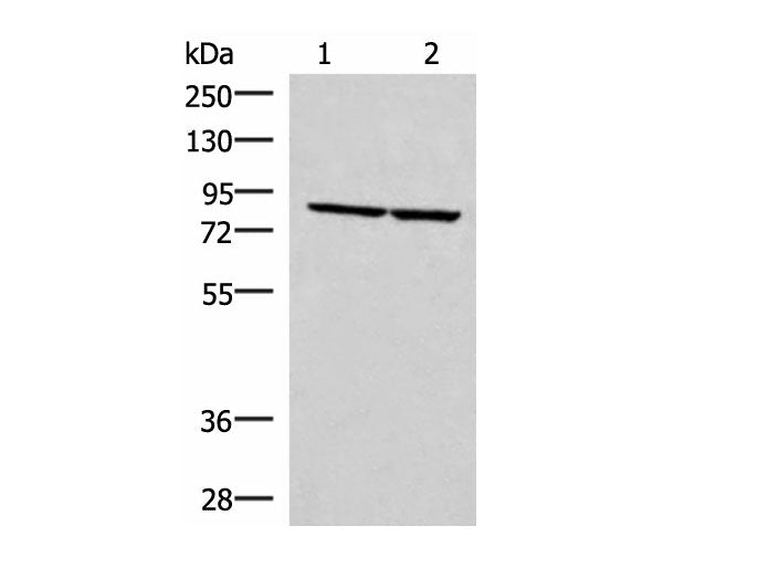 ABLIM3 Polyclonal Antibody Reactivity Human