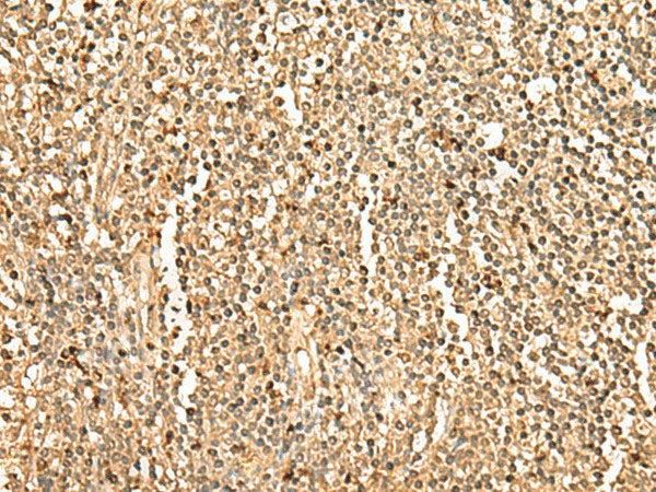 PPM1G Polyclonal Antibody Reactivity Human