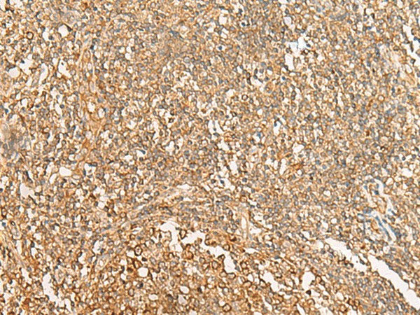 NARS Polyclonal Antibody Reactivity Human