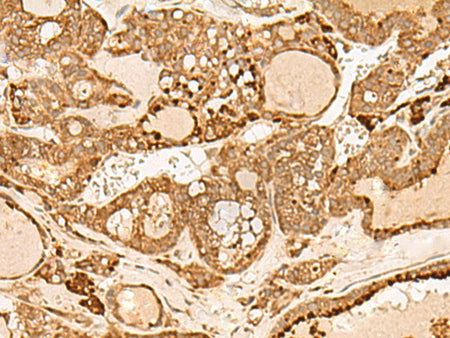 HIRIP3 Polyclonal Antibody Reactivity Human