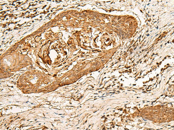 HIRIP3 Polyclonal Antibody Reactivity Human