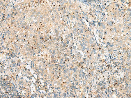 EIF3L Polyclonal Antibody Reactivity Human