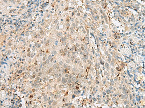 GTF3C2 Polyclonal Antibody