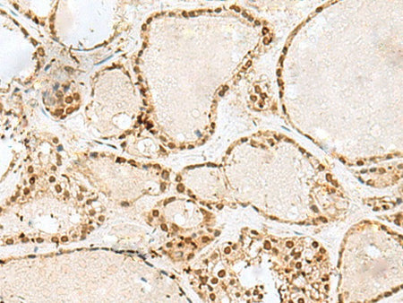 GTF3C2 Polyclonal Antibody