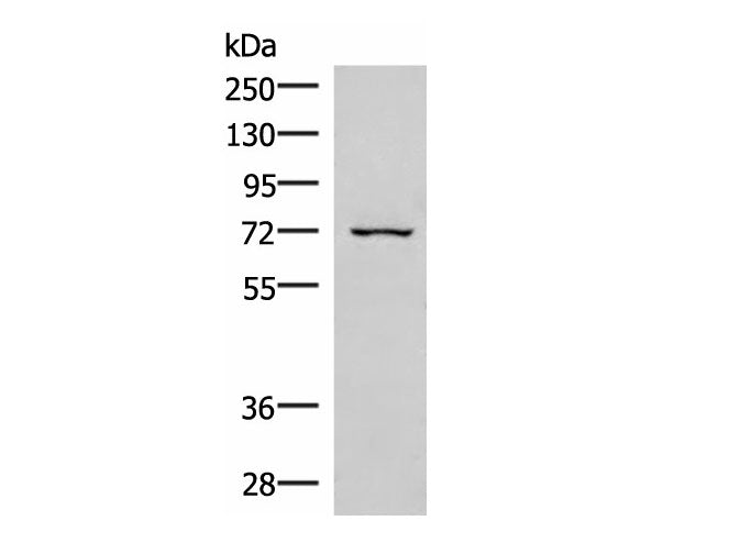 EIF2AK1 Polyclonal Antibody Reactivity Human