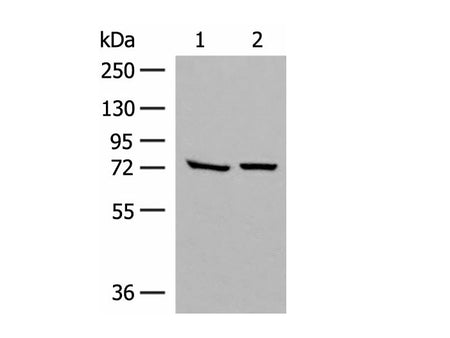 POMGNT1 Polyclonal Antibody Reactivity Human