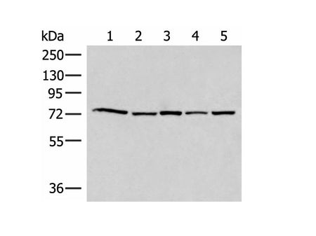 ATMIN Polyclonal Antibody Reactivity Human