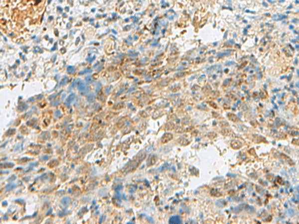 PRPF3 Polyclonal Antibody Reactivity Human