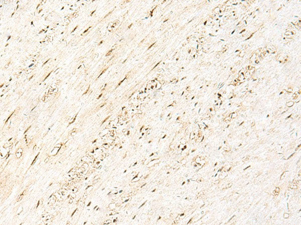 PRPF3 Polyclonal Antibody Reactivity Human