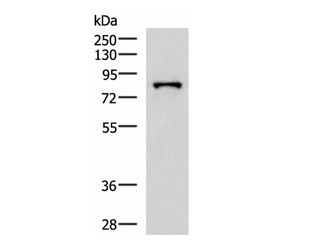 PRPF3 Polyclonal Antibody Reactivity Human