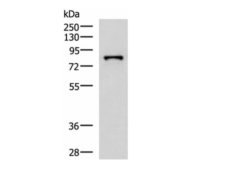 PRPF3 Polyclonal Antibody Reactivity Human