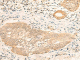 CALCOCO1 Polyclonal Antibody Reactivity Human