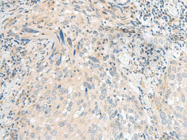 CALCOCO1 Polyclonal Antibody Reactivity Human
