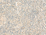 NGEF Polyclonal Antibody Reactivity Human, Biomarkers, Elabscience Biotechnology, MSE Supplies