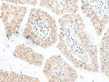 NGEF Polyclonal Antibody Reactivity Human