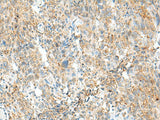MCCC1 Polyclonal Antibody Reactivity Human