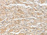 TTC12 Polyclonal Antibody