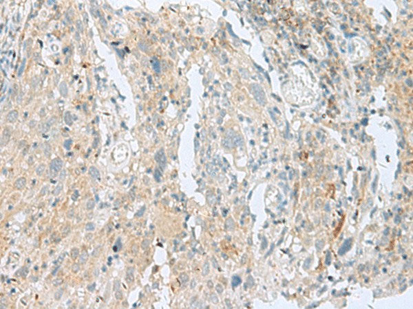 SLC26A3 Polyclonal Antibody Reactivity Human