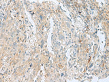SLC26A3 Polyclonal Antibody Reactivity Human