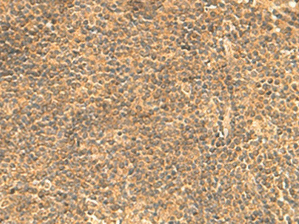 FAM186B Polyclonal Antibody