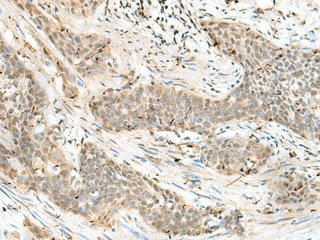 LIG4 Polyclonal Antibody Reactivity Human