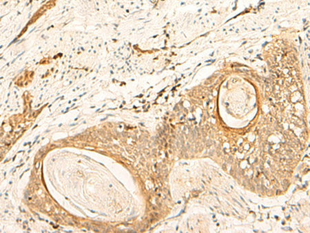 EIF3C Polyclonal Antibody Reactivity Human
