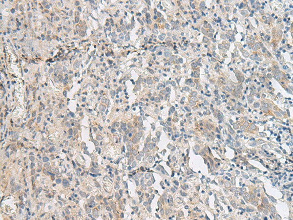 PCSK5 Polyclonal Antibody Reactivity Human