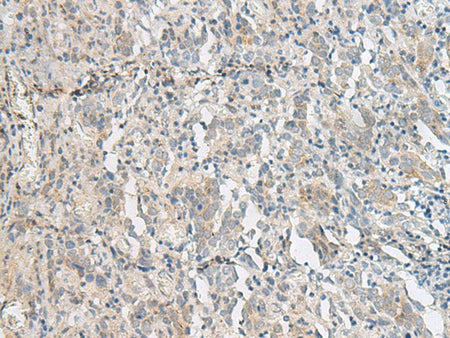 PCSK5 Polyclonal Antibody Reactivity Human