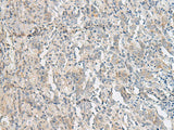 PCSK5 Polyclonal Antibody Reactivity Human