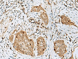 TEX11 Polyclonal Antibody Reactivity Human