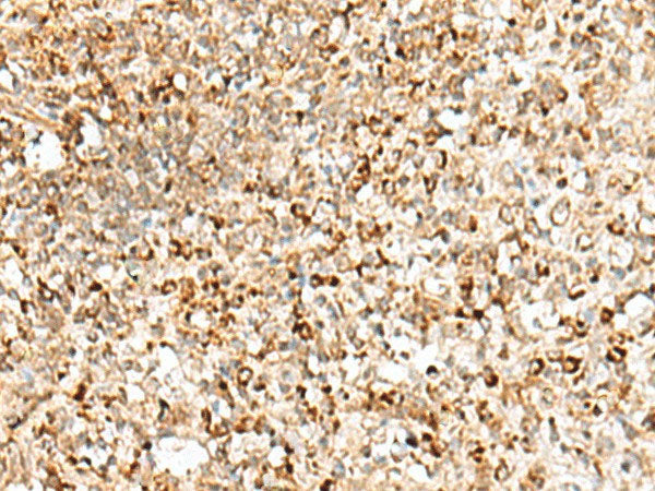 TEX11 Polyclonal Antibody Reactivity Human