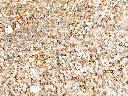 TEX11 Polyclonal Antibody Reactivity Human