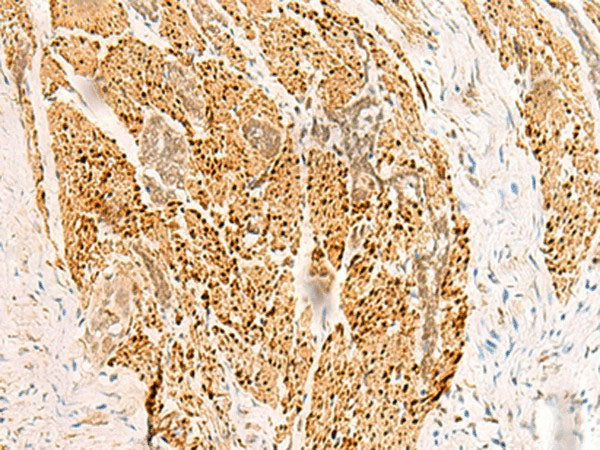 RFX6 Polyclonal Antibody Reactivity Human