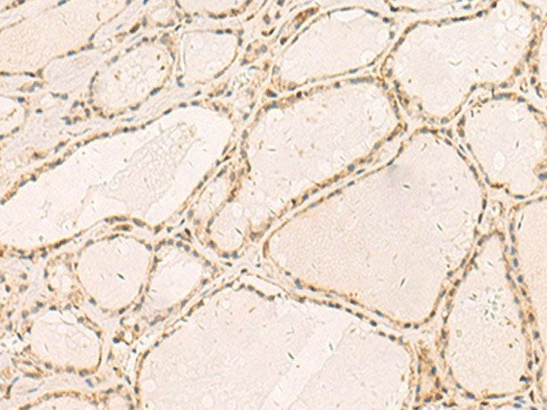 RFX6 Polyclonal Antibody Reactivity Human