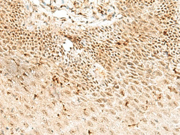 RBM10 Polyclonal Antibody Reactivity Human