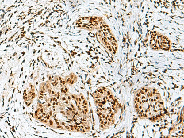 RBM10 Polyclonal Antibody Reactivity Human