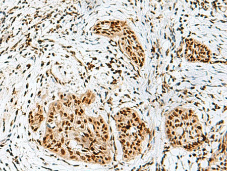 RBM10 Polyclonal Antibody Reactivity Human