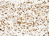 RBM12 Polyclonal Antibody Reactivity Human