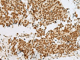RBM12 Polyclonal Antibody Reactivity Human