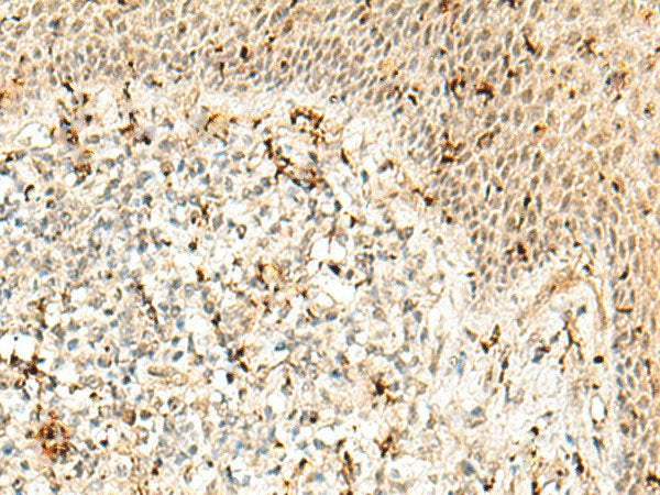 RBM15 Polyclonal Antibody Reactivity Human