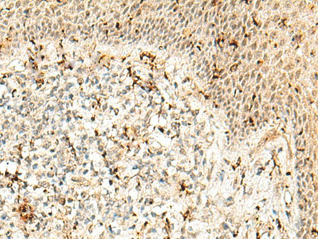 RBM15 Polyclonal Antibody Reactivity Human