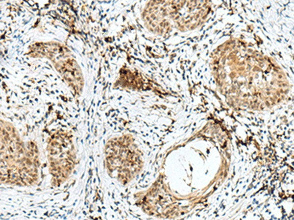 RBM15 Polyclonal Antibody Reactivity Human