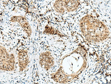 RBM15 Polyclonal Antibody Reactivity Human