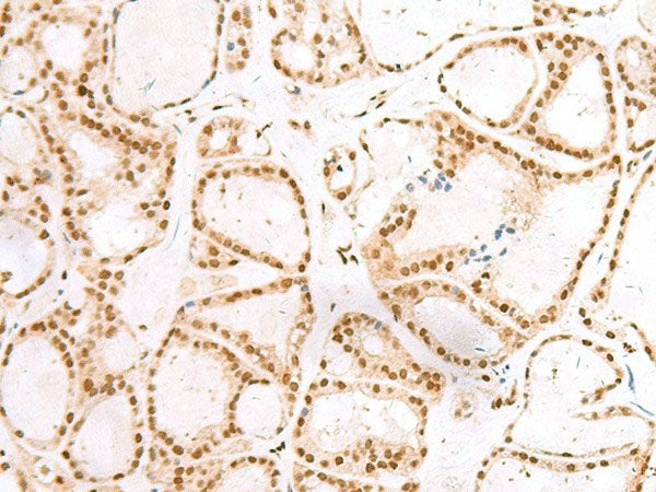 TCOF1 Polyclonal Antibody Reactivity Human