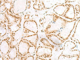 TCOF1 Polyclonal Antibody Reactivity Human