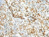 TCOF1 Polyclonal Antibody Reactivity Human