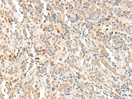 RBM19 Polyclonal Antibody Reactivity Human